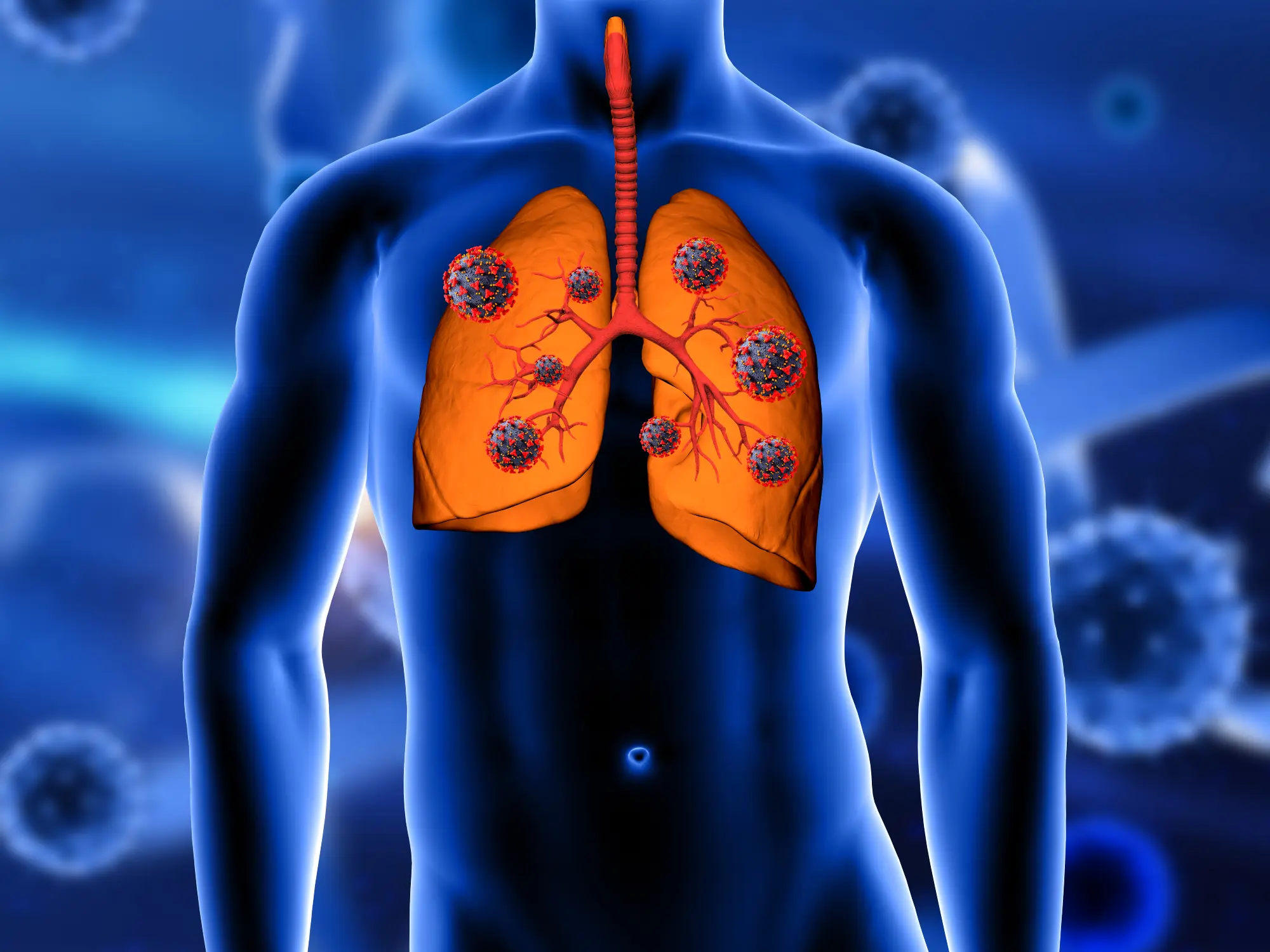 Ilustração Câncer de pulmão: saiba sobre sintomas, tratamentos e muito mais